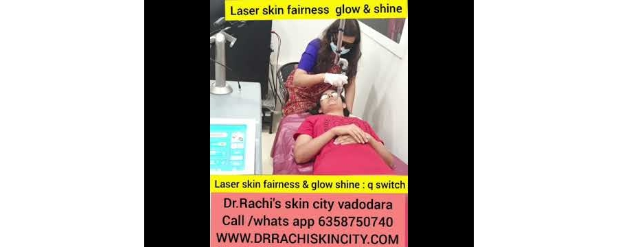 laser skin fairness